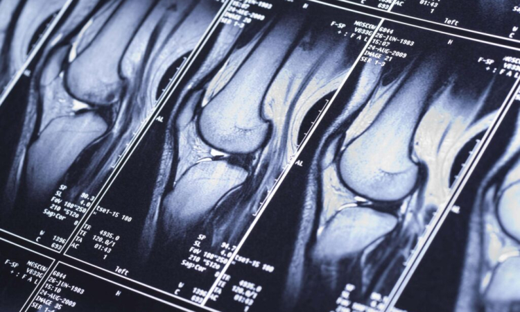 Првоедение МРТ в Бирюлево